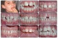 /album/orthodontics/orthodontis-6-jpg/